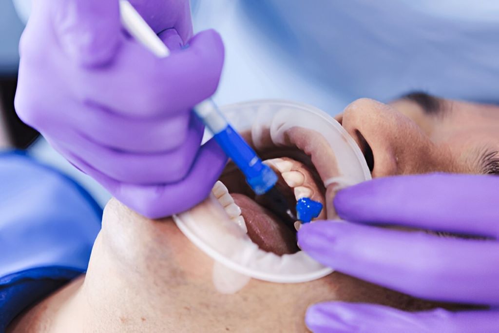 Fluoride Treatment Near You