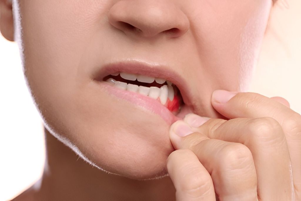 Gum Disease Treatment in SW Calgary, AB