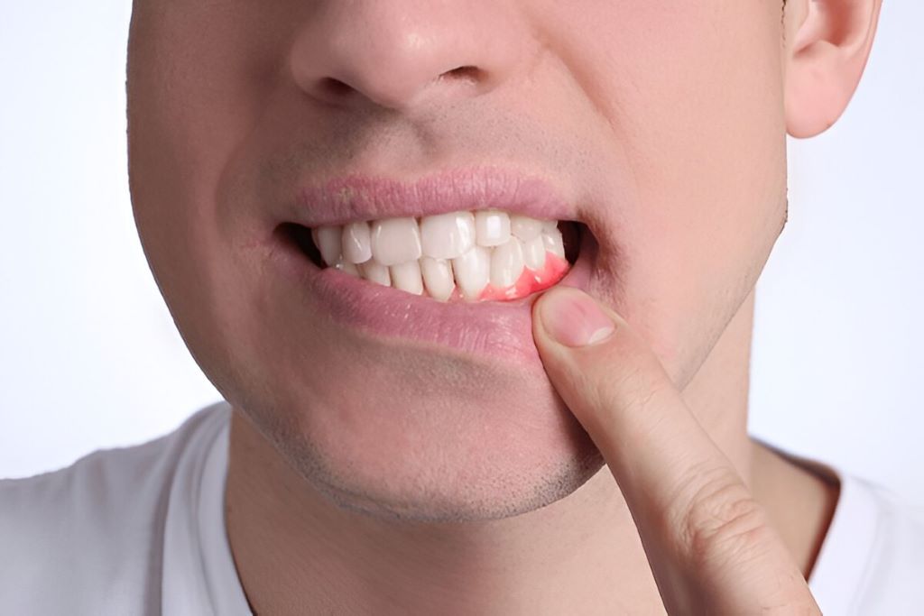 Gum Disease Treatment Near You