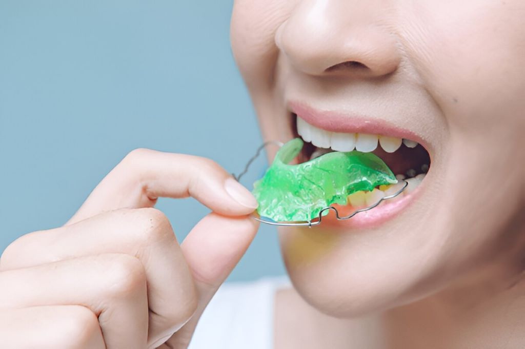 Orthodontic Retainers in SW Calgary, AB