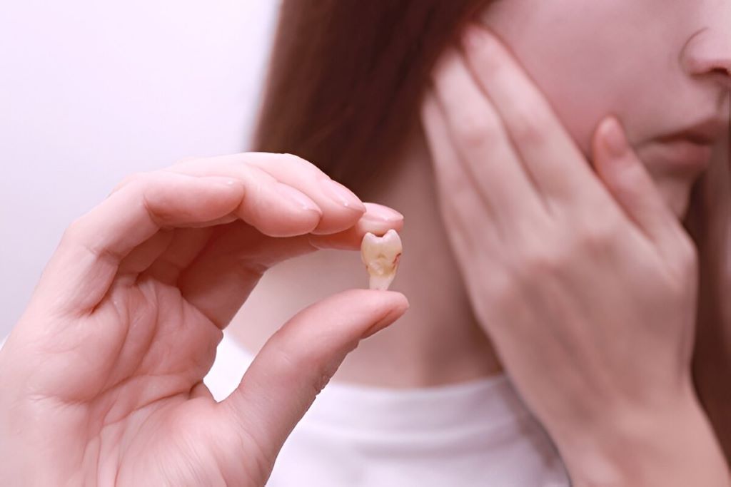Tooth Extractions in SW Calgary, AB