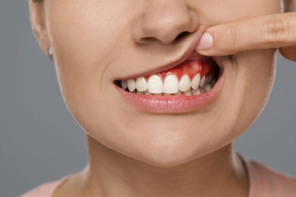 Tooth Pain & Abscess Treatment in SW Calgary, AB