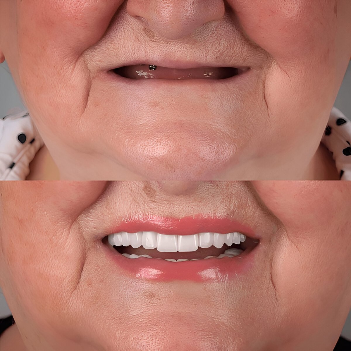 complete dentures near you