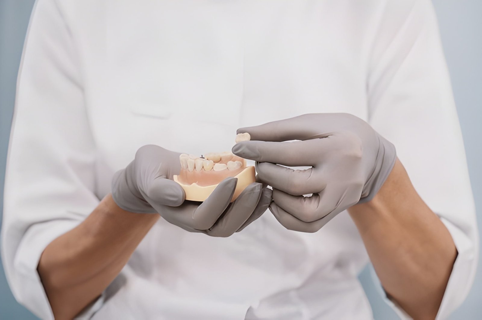dental crowns sw calgary