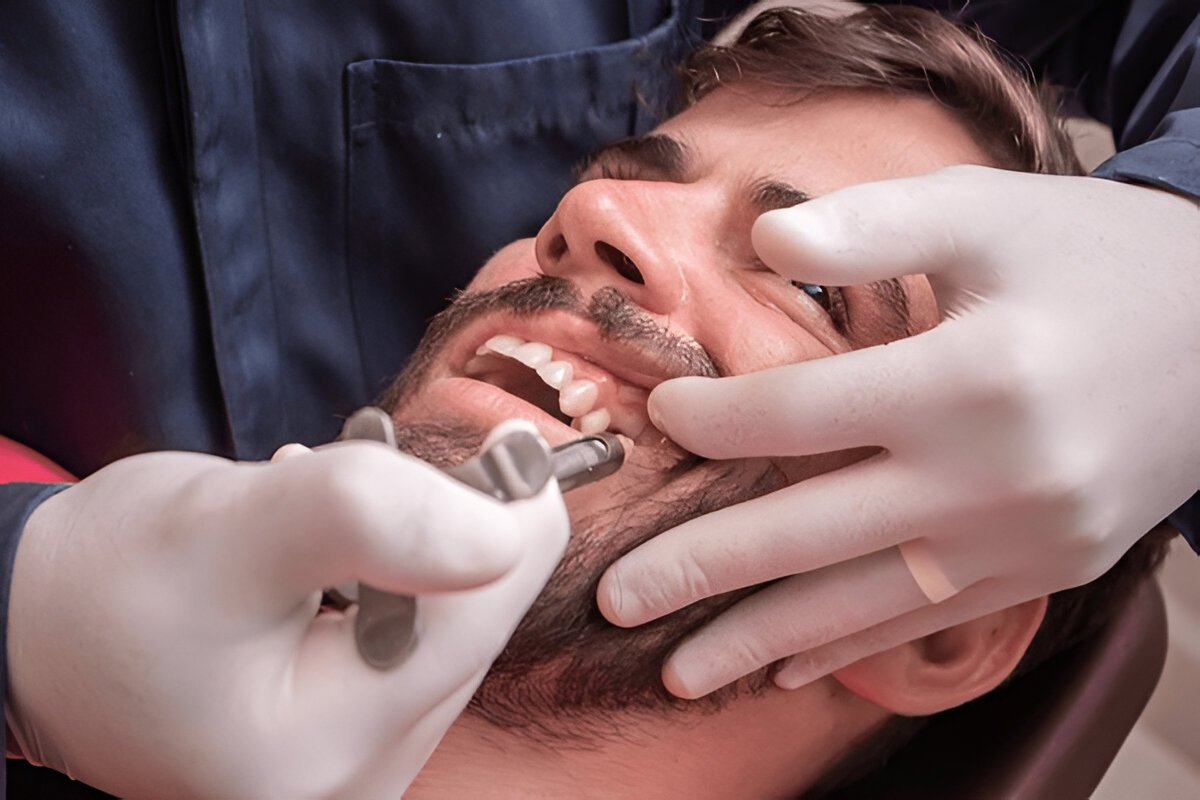 Oral & Nitrous Combined Sedation in SW Calgary