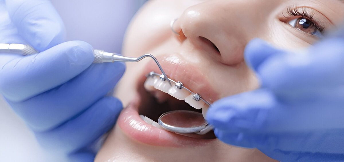 orthodontics in sw calgary