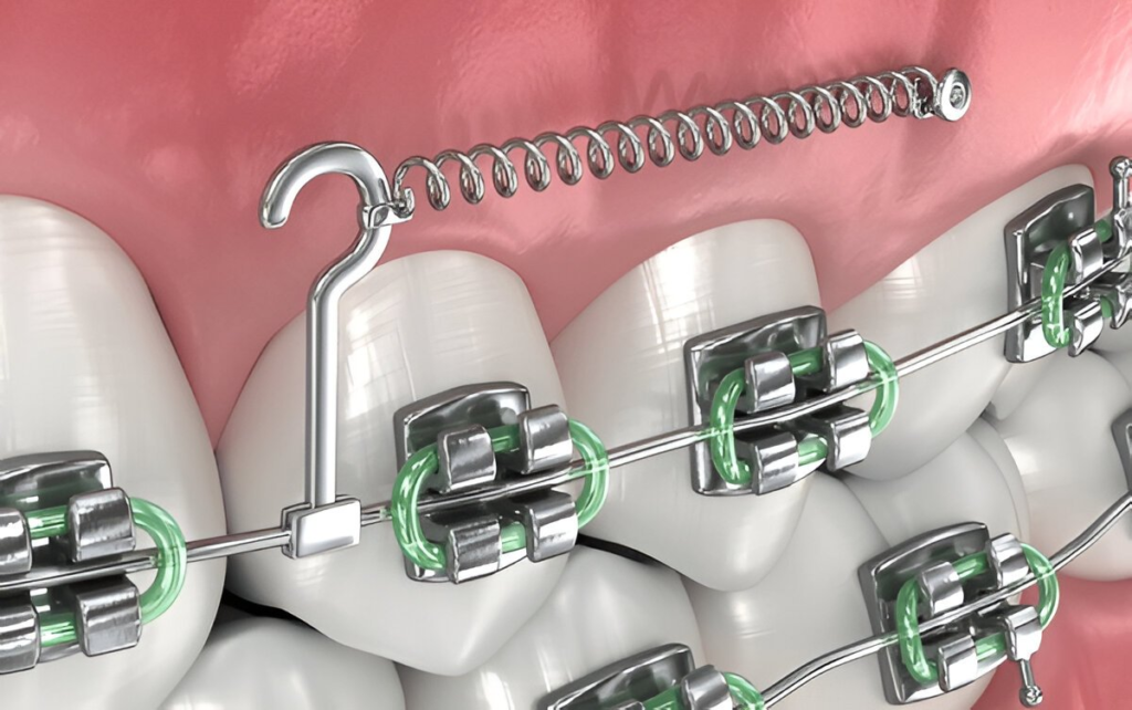 orthodontics near you