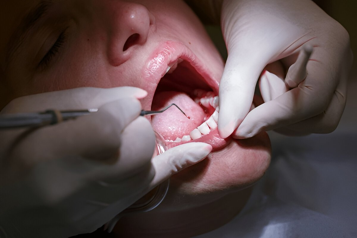 Periodontal Therapy in SW Calgary