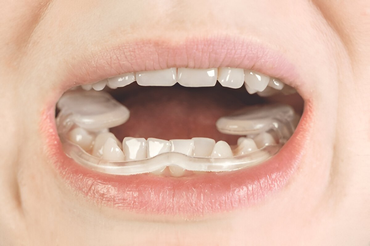 tmd treatment in sw calgary
