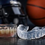 How Sports Guards Reduce The Risk Of Dental Emergencies